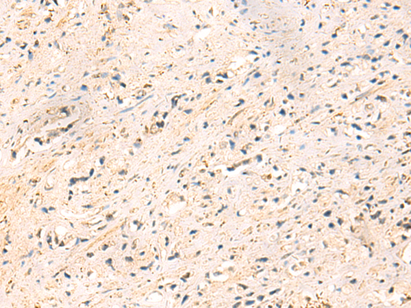 Rabbit Polyclonal Antibody to IP6K3