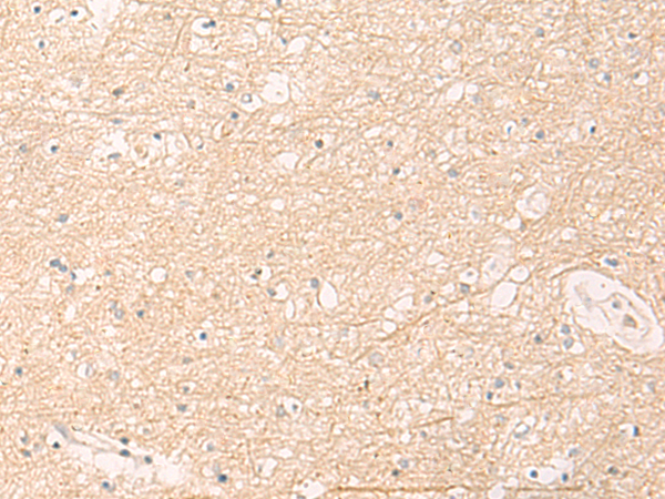 Rabbit Polyclonal Antibody to ELP1