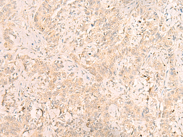 Rabbit Polyclonal Antibody to IL1RAPL2