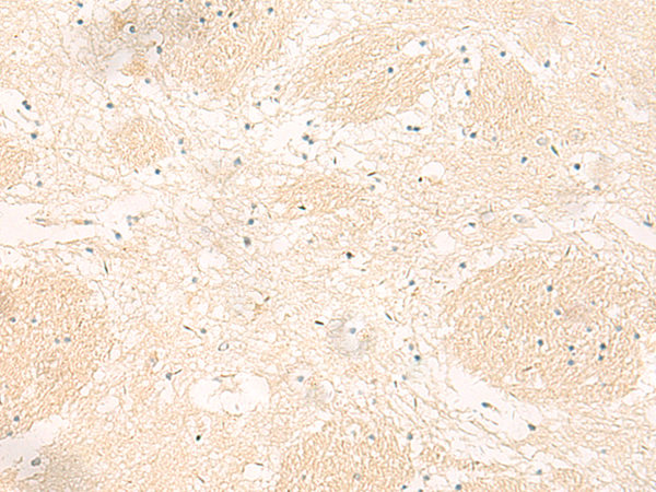 Rabbit Polyclonal Antibody to IL12B