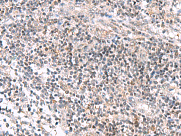Rabbit Polyclonal Antibody to IL36A