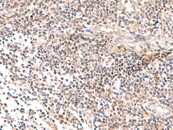 Rabbit Polyclonal Antibody to IL36B