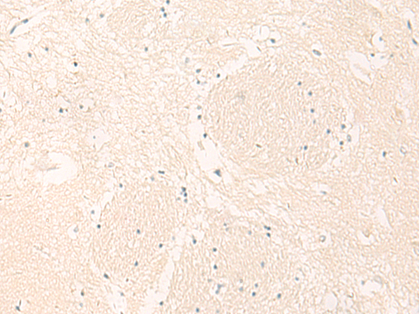 Rabbit Polyclonal Antibody to IL36RN