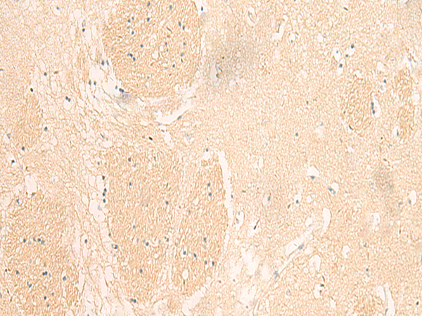 Rabbit Polyclonal Antibody to IL37