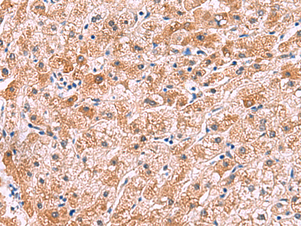 Rabbit Polyclonal Antibody to IL4R