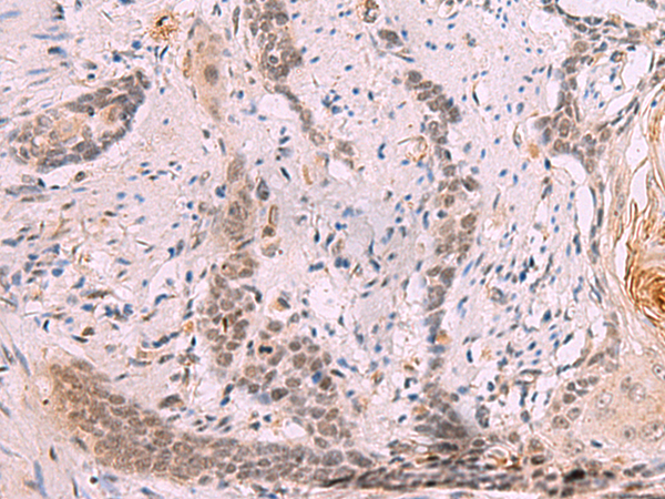 Rabbit Polyclonal Antibody to INO80