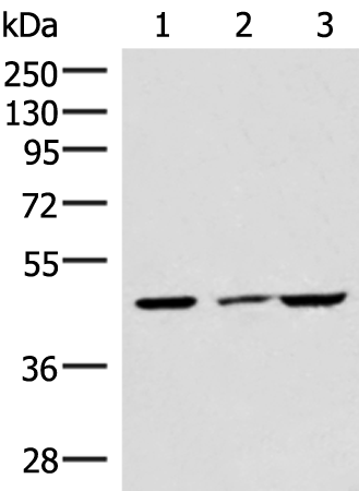 Rabbit Polyclonal Antibody to IP6K2