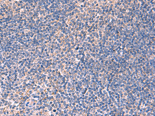 Rabbit Polyclonal Antibody to INPP5B