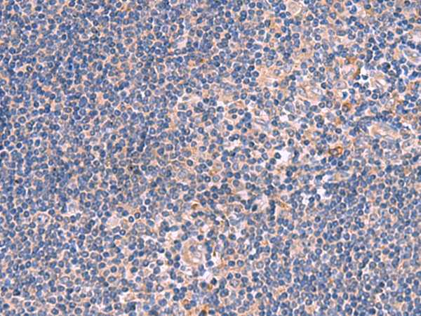 Rabbit Polyclonal Antibody to INSC