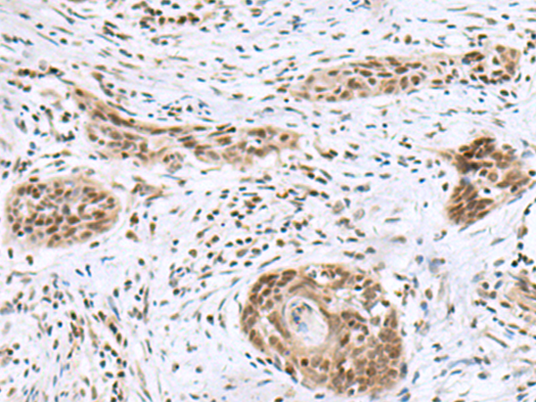 Rabbit Polyclonal Antibody to INSM1