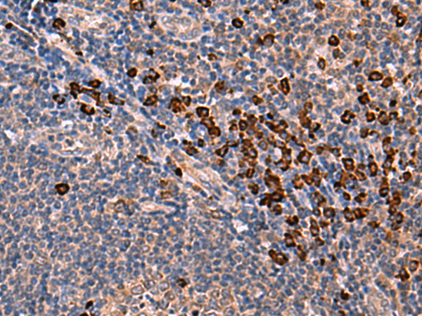 Rabbit Polyclonal Antibody to INSM2