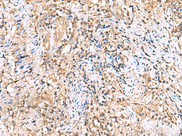 Rabbit Polyclonal Antibody to ITGA3