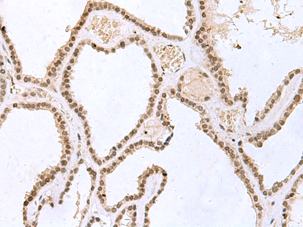 Rabbit Polyclonal Antibody to ITGB4