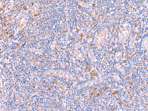 Rabbit Polyclonal Antibody to ITGB7