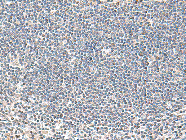 Rabbit Polyclonal Antibody to IFNA2