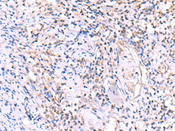 Rabbit Polyclonal Antibody to LMLN