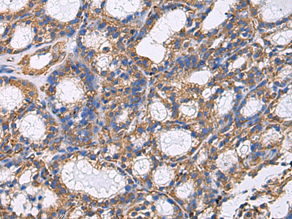 Rabbit Polyclonal Antibody to GRIA3