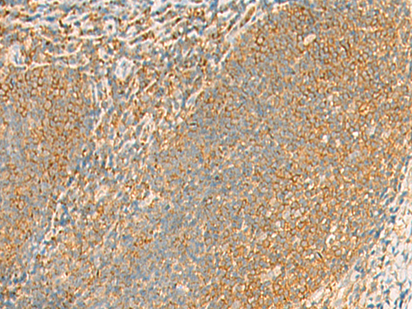 Rabbit Polyclonal Antibody to GRIA4