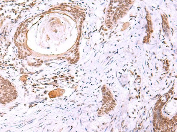 Rabbit Polyclonal Antibody to ITPKC