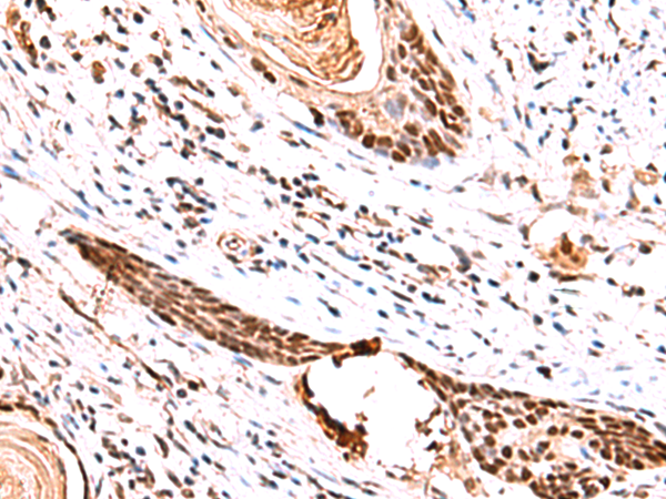 Rabbit Polyclonal Antibody to IRF2BP1