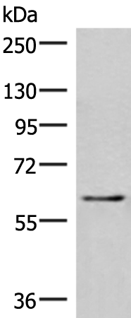 Rabbit Polyclonal Antibody to IRF2BP2