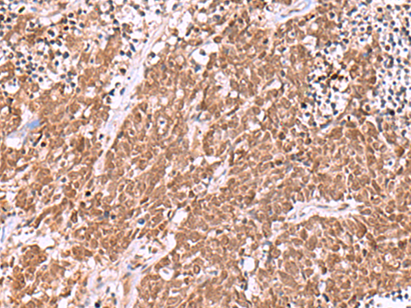 Rabbit Polyclonal Antibody to IRX6