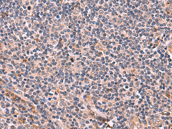 Rabbit Polyclonal Antibody to NMRK2