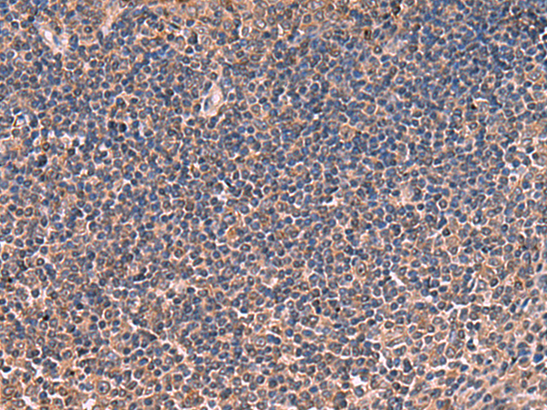 Rabbit Polyclonal Antibody to ITIH4