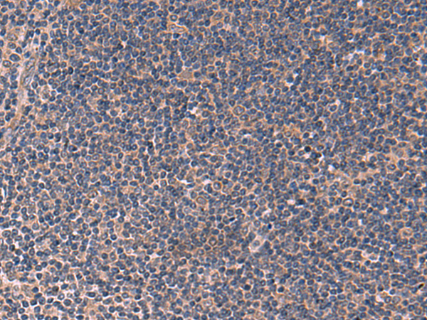 Rabbit Polyclonal Antibody to ITPR2