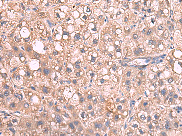 Rabbit Polyclonal Antibody to JAZF1