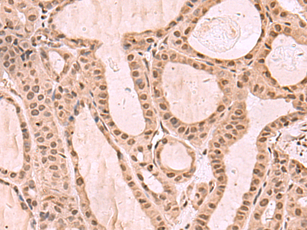 Rabbit Polyclonal Antibody to KDM7A