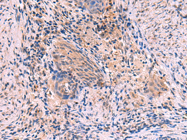 Rabbit Polyclonal Antibody to JPH1