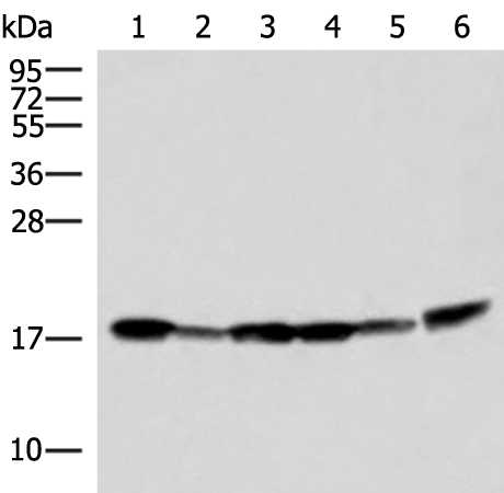 Rabbit Polyclonal Antibody to PEMT