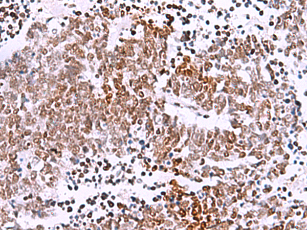 Rabbit Polyclonal Antibody to TMEM18