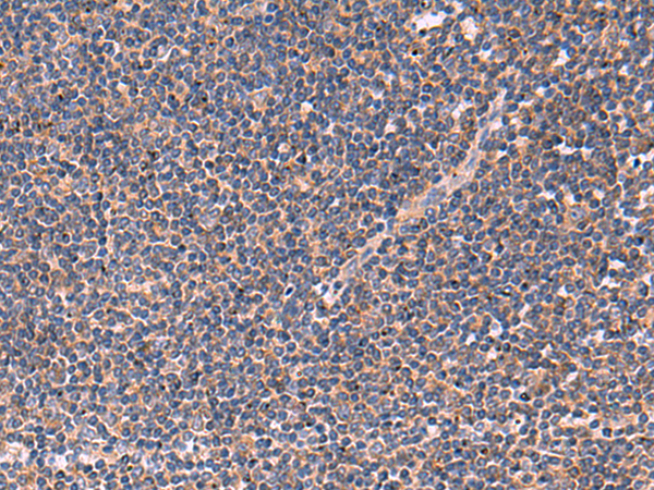 Rabbit Polyclonal Antibody to JPH2