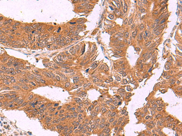 Rabbit Polyclonal Antibody to ZBTB33