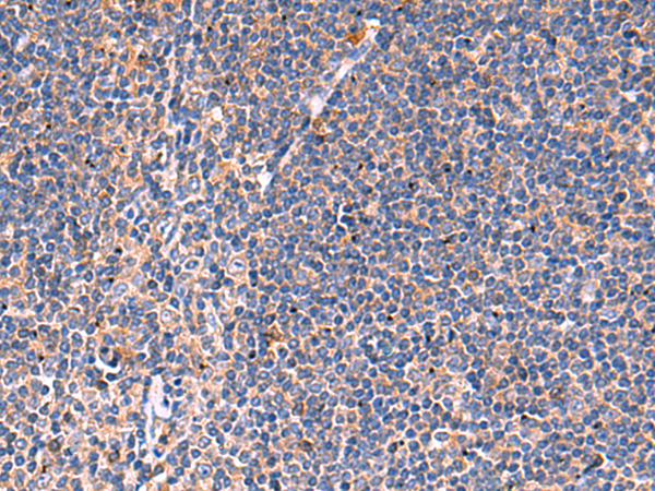 Rabbit Polyclonal Antibody to KLK9