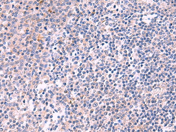 Rabbit Polyclonal Antibody to KANK3