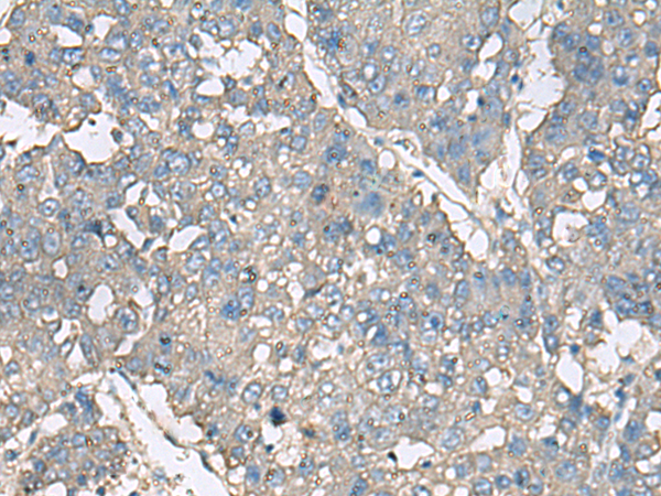 Rabbit Polyclonal Antibody to TNF