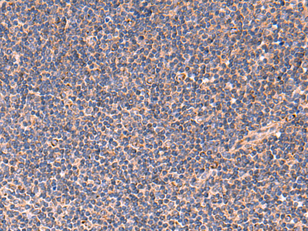 Rabbit Polyclonal Antibody to TNF