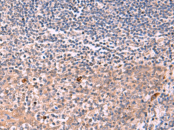 Rabbit Polyclonal Antibody to IFNA1/IFNA13