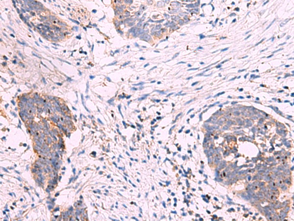 Rabbit Polyclonal Antibody to KANSL1L