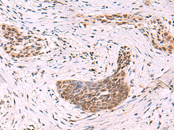 Rabbit Polyclonal Antibody to CREBBP