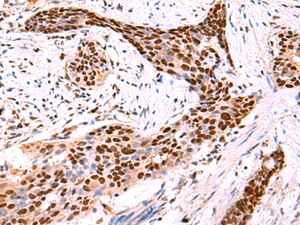 Rabbit Polyclonal Antibody to SOX2