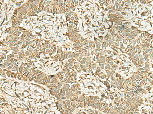 Rabbit Polyclonal Antibody to KAT7
