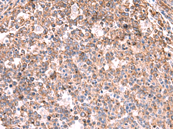 Rabbit Polyclonal Antibody to KBTBD11