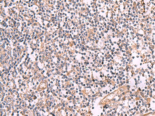 Rabbit Polyclonal Antibody to SLC12A5