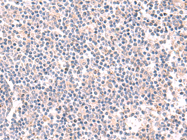 Rabbit Polyclonal Antibody to SLC12A7