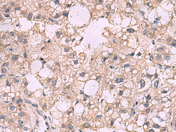 Rabbit Polyclonal Antibody to KCNIP1