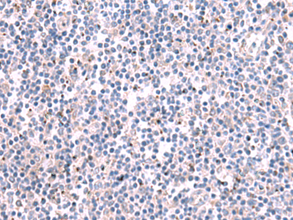 Rabbit Polyclonal Antibody to KCNK10
